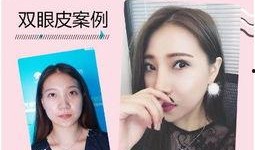 整容医院爆料案例视频,真实案例曝光，美丽背后隐藏的惊悚真相