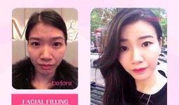 整容医院爆料案例视频,真实案例曝光，美丽背后隐藏的惊悚真相